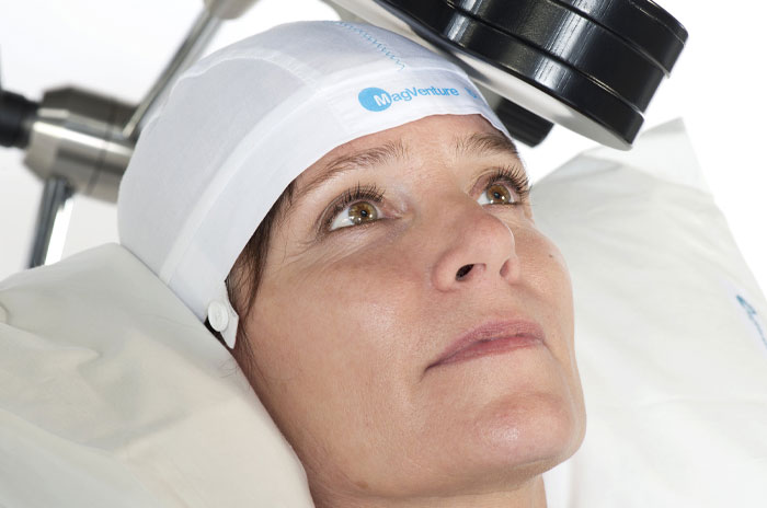 درمان با rtms