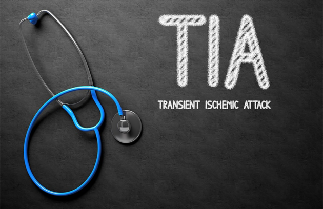 آیا سکته مغزی خفیف نیاز به مراجعه به پزشک دارد؟